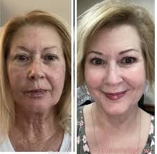 Elite Smiles & Medaesthetics