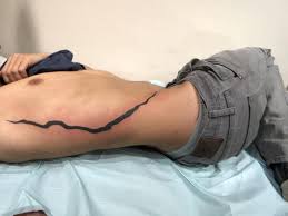 A few i can rember, a tribe whoes women stretched body modification. 4529 Best Sage Images On Pholder Naruto Food And Blackdesertonline