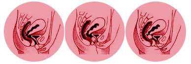 The use of a yoni egg involves flexing certain muscles of the perineum to tone the muscles and increase sensation in the area. Yoni Eggs And Jade Eggs Free Uk Shipping