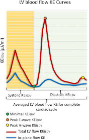 Velocity and mass from force vs. Left Ventricular Blood Flow Kinetic Energy After Myocardial Infarction Insights From 4d Flow Cardiovascular Magnetic Resonance Journal Of Cardiovascular Magnetic Resonance Full Text