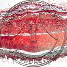 Image result for Strophanthus kombe