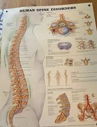 Human Spine Disorders Anatomical Chart Paperback By