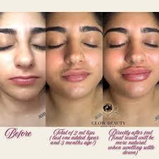 Glow Beauty Munique added a new photo.