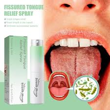 Image result for Fissured tongue
