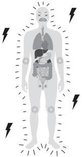 Image result for Somatization Management