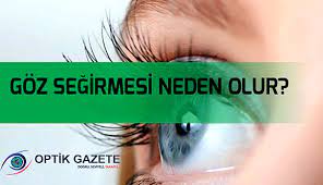 goz segirmesi deyip gecmeyiniz optik gazete