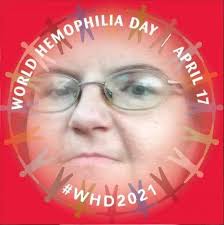 This is just a thought. God used a golden snake to heal the people bitten  by the serpent. Am I the only one to think that to save someone from a  venomous