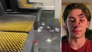 American stabbed defending women