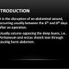 The mean period of hospitalization was 14.5. 1