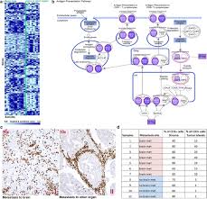 People should know the signs that breast cancer has spread to other parts of the body, a charity says. T Lymphocytes Facilitate Brain Metastasis Of Breast Cancer By Inducing Guanylate Binding Protein 1 Expression Springerlink