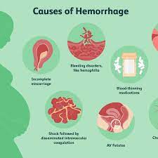 If you are pregnant or planning to become pregnant, tell your doctor before having the procedure. How To Know If You Re Hemorrhaging Due To A Miscarriage