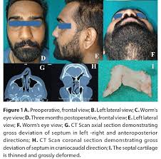 Clinical Journal of Plastic and Reconstructive Surgery