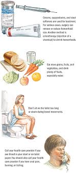Rubber band ligation of hemorrhoids: Hemorrhoids Digestive Health And Disorders Spectrum Health