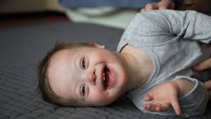 Facts and faq about down syndrome. Endlich Hersteller Zeigt Erstmals In Werbung Kinder Mit Down Syndrom Bunte De