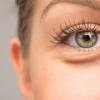 Glaucoma symptoms comprise blurred vision, increased sensitivity to light, headaches and nausea, due to high fluid pressure in the optic nerve of the eye. 1