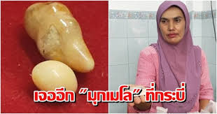 หนุ่มรถบรรทุกซื้อหอยกระโจงโดง 50 บาท จากสะพานปลาชลบุรี ได้ของเเถมเป็น มุกเมโล ของแท้ ราคาเป็นล้าน พี่มลเทียร จันสุข อายุ 40 ปี อาชีพขับ. à¸š à¸²à¸™à¹€à¸¡ à¸­à¸‡ à¹€à¸ˆà¸­à¸­ à¸ à¸¡ à¸à¹€à¸¡à¹‚à¸¥ à¸ªà¸²à¸§à¸£ à¸²à¸™à¸‚ à¸²à¸‡à¹à¸à¸‡à¸à¸£à¸°à¸š à¹€à¸ à¸šà¸£ à¸à¸©à¸²à¸™à¸²à¸™à¸à¸§ à¸² 30 à¸› à¸¢ à¸™à¸‚à¸­à¸‡à¹à¸—