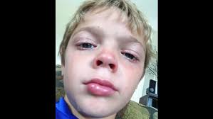 Cary Cormier (@cary_cormier)