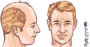 الصلع المبكر عند الرجال اليكم العلاج السريع قبل الصلع التام Male Sketch Art Male