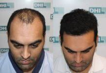 Zynova Shalby Hospitals Appoints Reny Varghese as Chief Operating Officer  (COO)