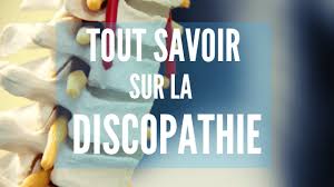 Bonjour, je souffre de discopathie l3 l4 l5 s1. Discopathie L5 S1 Que Faire Causes Symptomes Et Traitement