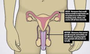 Man To Have A Hysterectomy After Discovering He Has A Womb Daily Mail Online