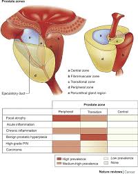 In young men, the prostate is about the size of a walnut. Prostate Adenoma An Overview Sciencedirect Topics
