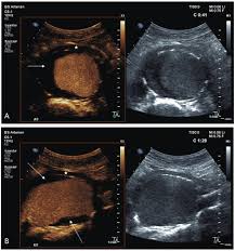 218 anatomy & physiology coloring workbook 21. Contrast Enhanced Ultrasound Of The Abdominal Aorta Current Status And Future Perspectives Vasa