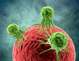 When cancerous tumors form on connective tissues, it is a sarcoma. Is Mesothelioma A Slow Growing Cancer Pintas Mullins Law Firm