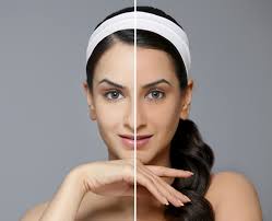 If your uneven texture is thanks to acne, your treatment plan should be customised to tackle both these concerns. Have Patchy Or Uneven Skin Tone Try These 5 Natural Homemade Remedies