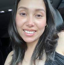 What products can be used to help with postpartum stretch marks?