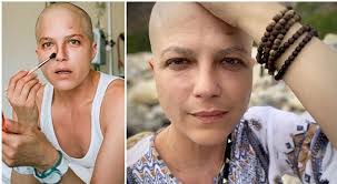Přečtěte si více o symptomech, diagnóze, léčbě, komplikacích, příčinách a prognóze. Selma Blair Podstupuje Lecbu Roztrousene Sklerozy Inspiruje Nemocne Na Instagramu Expres Cz