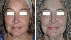 Frank Wasserman's Instagram, Twitter & Facebook