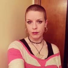 Here Is A Tip If You Ever Get Splat Dye On Your Skin Or Scalp Lemon Juice Is What Worked Best For Me To Remove It Hair Dye Removal Dyed Hair