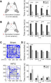 We assume that the sphere is homogeneous, with a. Longitudinal Functional Assessment Of Brain Injury Induced By High Intensity Ultrasound Pulse Sequences Scientific Reports