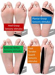 Image result for Babinski Reflex