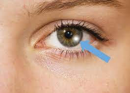 Augendiagnose 12 Dinge Die Man An Den Augen Ablesen Kann Curioctopus De