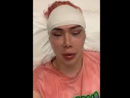 We talk to a woman who had a nose job to find out what it's really like to get plastic surgery. Brit Influencer Undergoes 18 Surgeries To Look Korean Brit Influencer Who Identifies As Korean Undergoes 18 Cosmetic Surgeries To Look Like Bts Singer Trending Viral News