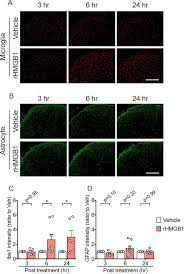 We did not find results for: Perineural High Mobility Group Box 1 Induces Mechanical Hypersensitivity Through Activation Of Spinal Microglia Involvement Of Glutamate Nmda Receptor Dependent Mechanism In Spinal Dorsal Horn Sciencedirect