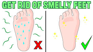 Check spelling or type a new query. How To Stop Having Sweaty And Smelly Feet Naturally Youtube