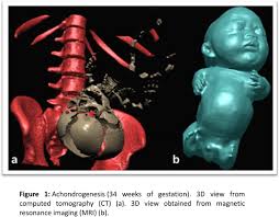 Sample size determination and power analysis using the G*Power software