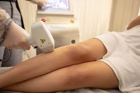 Laser hair removal is a permanent solution to reducing and removing unwanted hair by using laser technology. Laser Hair Removal Divine Spa Brampton Skincare Specialist