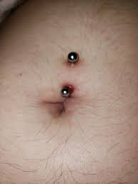 So My Friend Got Her Bellybutton Peirced About Three Months Ago She Says The Top Feels Healed But The Bottom Isnt Going As Well I Was Thinking Tea Tree Oil Diluted With