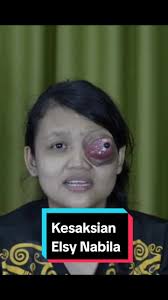 Elsy Nabila Mata Sembuh