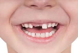 Collection by sonja thompson • last updated 15 hours ago. Eruption Patterns Pediatric Dental Blog