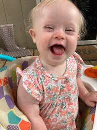 Emma has Down syndrome and today is her 1st birthday