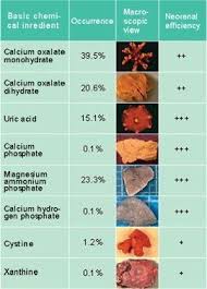 Pin On Kidney Stones