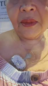 Heart monitor for 2 weeks..EP trying to figure out if afib came back or are  PVCs