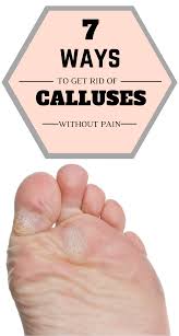 Pin On Natural Remedies