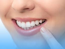 Composite Bonding: Enhance Your Smile with Confidence