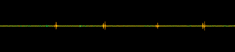 You can edit audio files with tools like cut, copy, paste. Freesound Iphone Wav By Thegoose09